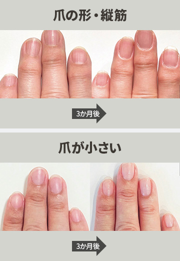 爪の形・縦筋、爪が小さい